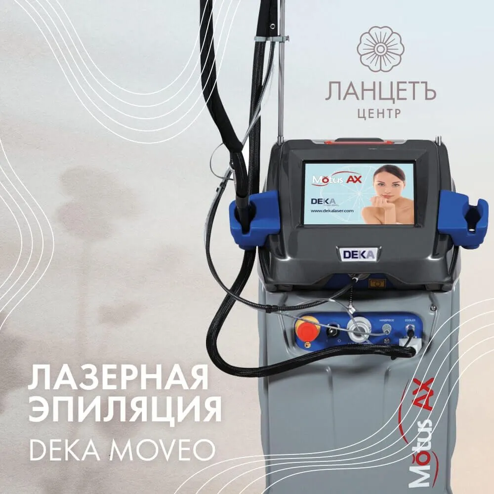 Лазерная эпиляция