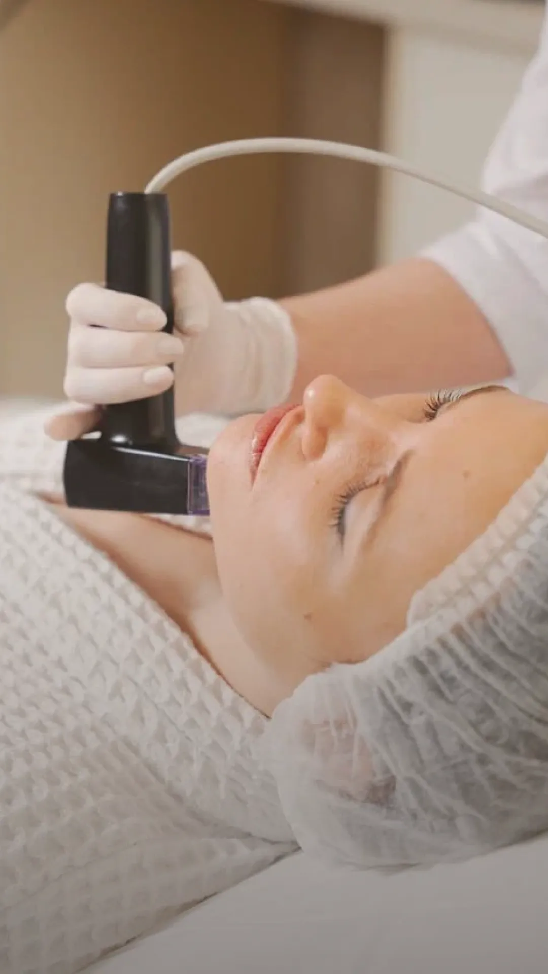 Игольчатый RF-лифтинг — скидка до 50%