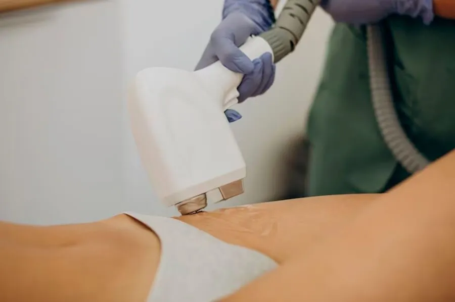 Лазер в косметологии