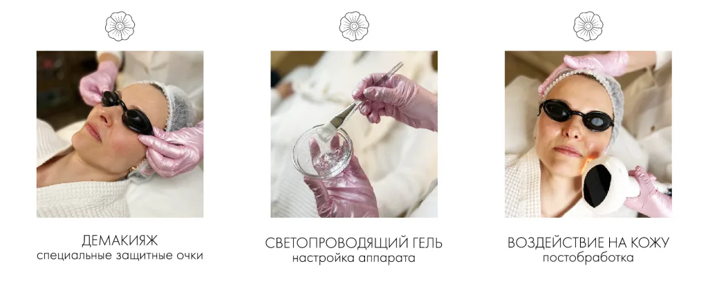 фототерапия.png