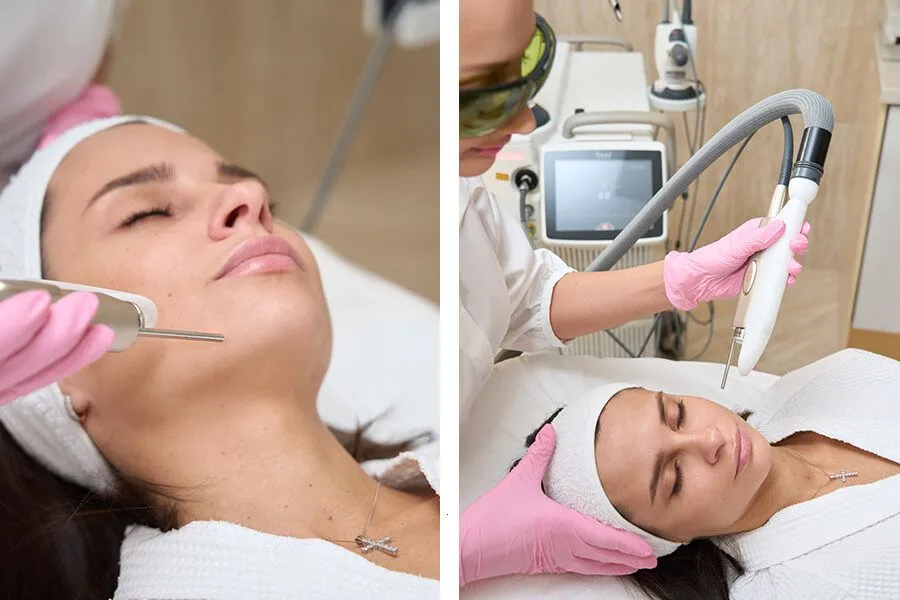 Шлифовка лица лазером