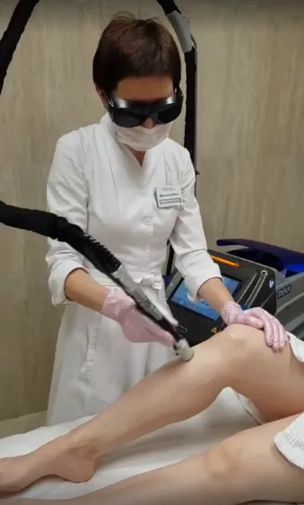 лазерная эпиляция.PNG