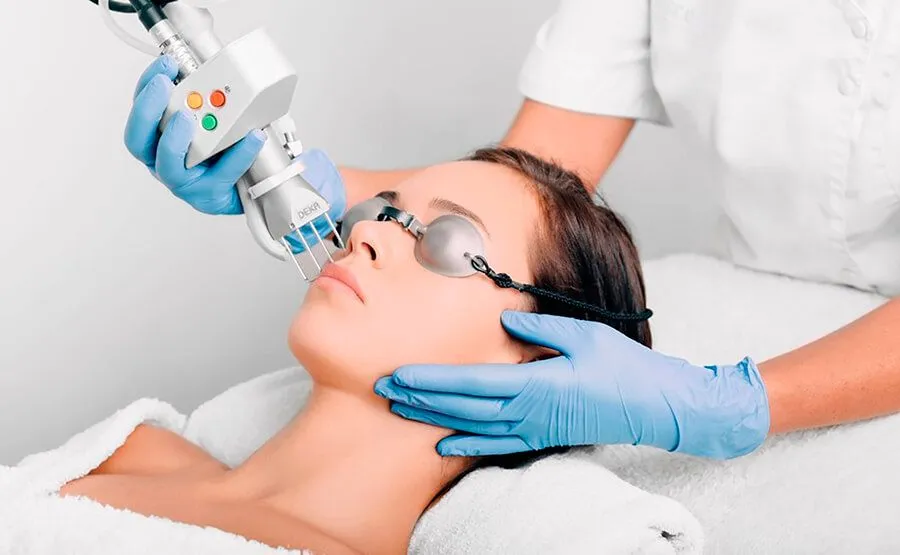 Лазерная шлифовка лица