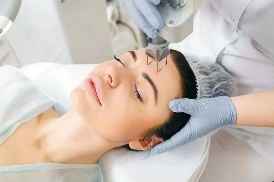 Лазерная полировка лица