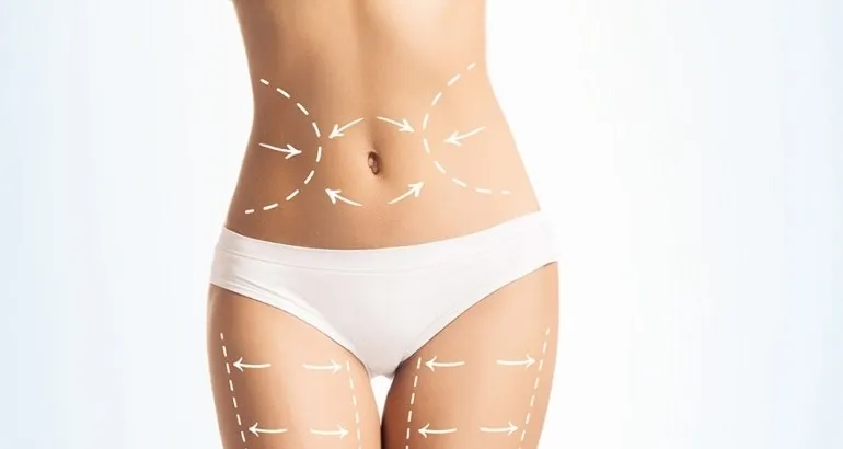 lipo3 770x410 - Уколы для похудения. Помогают ли липолитики худеть?